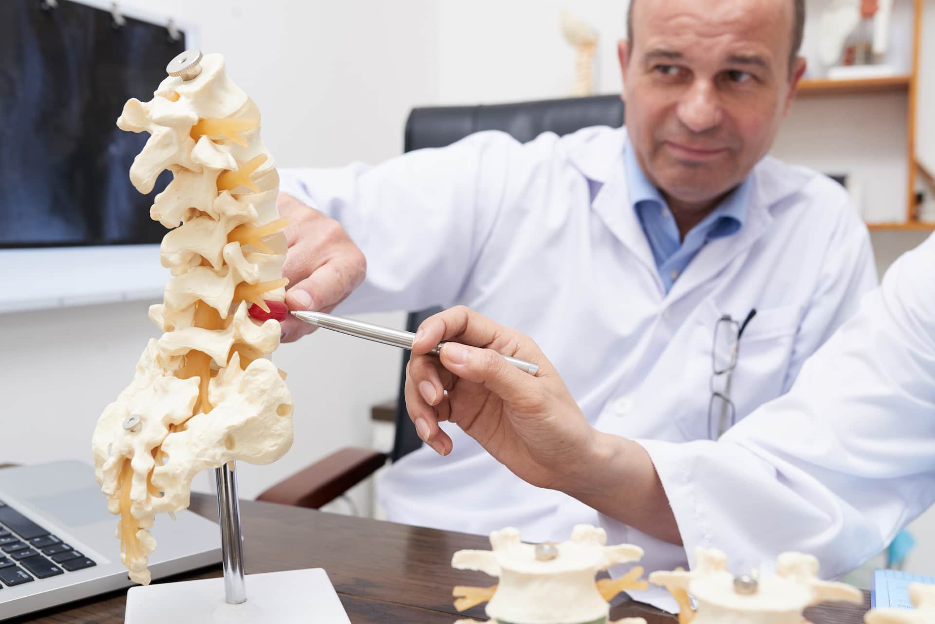 Doctor pointing to spine model showing inflammation areas